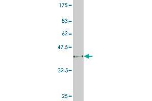 Western Blotting (WB) image for anti-Muscle, Skeletal, Receptor Tyrosine Kinase (MUSK) (AA 301-400) antibody (ABIN518096)