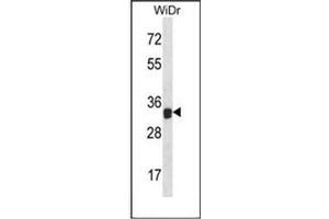Western blot analysis of Galectin-9 Antibody (N-term) in WiDr cell line lysates (35ug/lane).