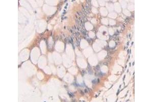 Figure. (BMP2 antibody  (AA 283-396))