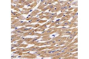 Immunofluorescent analysis of paraformaldehyde-fixed rat heart using,MYBPC3 (ABIN7074729) at dilution of 1: 2000 (MYBPC3 antibody)