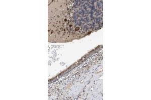 Immunohistochemical staining of human bronchus with CCDC146 polyclonal antibody  shows moderate cytoplasmic positivity in respiratory epithelial cells at 1:50-1:200 dilution. (CCDC146 antibody)