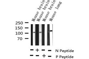Western blot analysis of Phospho-B-RAF (Ser446) expression in various lysates (BRAF antibody  (pSer446))