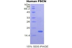 SDS-PAGE (SDS) image for Fascin (FSCN1) (AA 277-396) protein (His tag) (ABIN2121006)