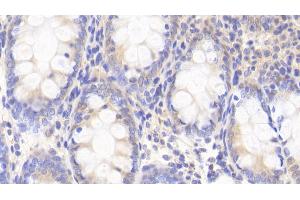 Detection of DYRK1A in Human Colon Tissue using Polyclonal Antibody to Dual Specificity Tyrosine Phosphorylation Regulated Kinase 1A (DYRK1A) (DYRK1A antibody  (AA 16-300))