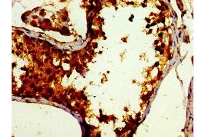 Immunohistochemistry of paraffin-embedded human testis tissue using ABIN7165242 at dilution of 1:100 (DBF4 antibody  (AA 101-281))