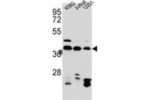 Western Blotting (WB) image for anti-Heterogeneous Nuclear Ribonucleoprotein C (C1/C2) (HNRNPC) antibody (ABIN2995806) (HNRNPC antibody)