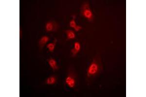 Immunofluorescent analysis of SMAD4 staining in HeLa cells. (SMAD4 antibody  (N-Term))