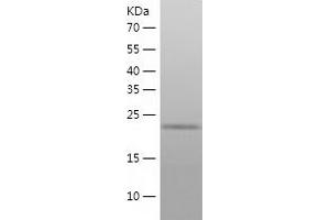 Western Blotting (WB) image for Fibroblast Growth Factor 23 (FGF23) (AA 25-251) protein (His tag) (ABIN7288739) (FGF23 Protein (AA 25-251) (His tag))