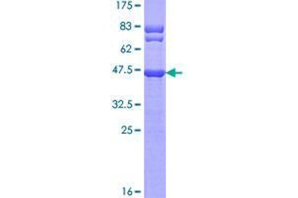 TTC9C Protein (AA 1-171) (GST tag)