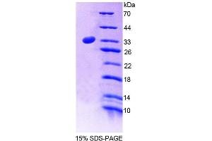 SDS-PAGE (SDS) image for Protein tyrosine Phosphatase, Non-Receptor Type 2 (PTPN2) (AA 1-257) protein (His tag) (ABIN4989861)
