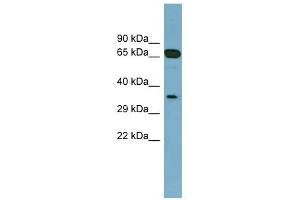 GLOD4 antibody used at 1 ug/ml to detect target protein. (GLOD4 antibody  (Middle Region))