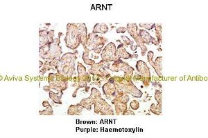 Researcher: Hiten D. (ARNT antibody  (C-Term))