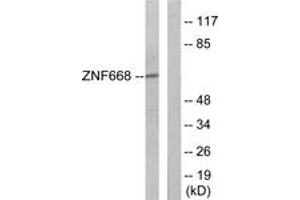 Western blot analysis of extracts from Jurkat cells, using ZNF668 Antibody. (ZNF668 antibody  (AA 271-320))