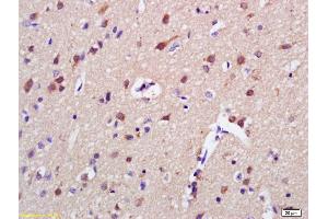 Formalin-fixed and paraffin embedded rat brain labeled with Anti-AKAP7 Polyclonal Antibody, Unconjugated (ABIN1387303) at 1:200 followed by conjugation to the secondary antibody and DAB staining (AKAP7 antibody  (AA 31-80))