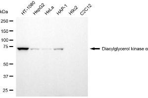 Western blotting analysis using diacylglycerol kinase alpha antibody (ABIN7798326). (DGKA antibody)