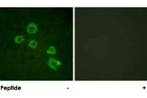 Immunofluorescence analysis of HUVEC cells, using PLA2G4A polyclonal antibody . (PLA2G4A antibody)