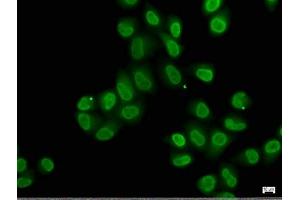Immunofluorescence staining of Hela cells with ABIN7140239 at 1:50, counter-stained with DAPI. (Znf423 antibody  (AA 39-57))
