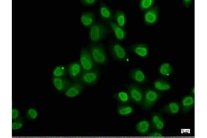 Immunofluorescence staining of Hela cells with ABIN7140239 at 1:50, counter-stained with DAPI. (Znf423 antibody  (AA 39-57))