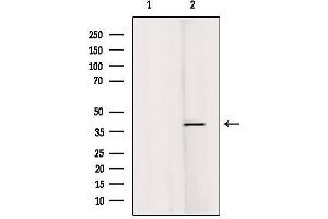 Western blot analysis of extracts from Hela, using RASSF1 Antibody. (RASSF1 antibody  (Internal Region))