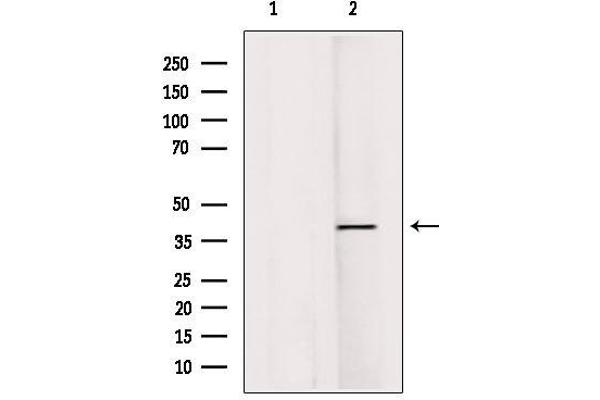 RASSF1 antibody  (Internal Region)