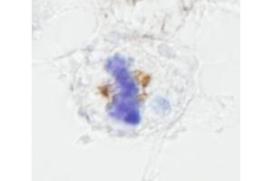 Immunohistochemistry (IHC) image for anti-Nuclear Mitotic Apparatus Protein 1 (NUMA1) (AA 900-950) antibody (ABIN7448994)