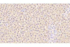Detection of TFR in Rat Liver Tissue using Polyclonal Antibody to Transferrin Receptor (TFR) (Transferrin Receptor antibody  (AA 587-756))