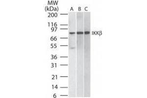 Image no. 1 for anti-Inhibitor of kappa Light Polypeptide Gene Enhancer in B-Cells, Kinase beta (IKBKB) antibody (ABIN208069) (IKBKB antibody)