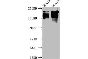 Western Blot Positive WB detected in: Rat Brain whole cell lysate, Mouse Brain whole cell lysate All lanes: TrkA Antibody at 1:1000 Secondary Goat polyclonal to rabbit IgG at 1/50000 dilution Predicted band size: 88, 87, 84, 78 kDa Observed band size: 145 kDa (Recombinant TRKA antibody)