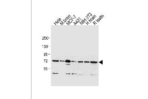 All lanes : Anti-MTA1 Antibody (C-term) at 1:1000 dilution Lane 1: Hela whole cell lysate Lane 2: mouse brain lysate Lane 3: MCF-7 whole cell lysate Lane 4: A431 whole cell lysate Lane 5: NIH-3T3 whole cell lysate Lane 6: human brain lysate Lane 7: rat testis lysate Lysates/proteins at 20 μg per lane. (MTA1 antibody  (C-Term))
