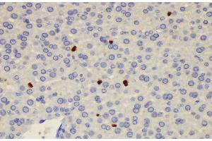 Immunohistochemistry of paraffin-embedded Rat liver using S100a8 Polycloanl Antibody at dilution of 1:200 (S100A8 antibody)