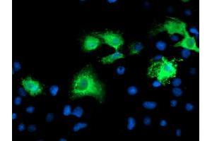 Anti-KATNB1 mouse monoclonal antibody (ABIN2455151) immunofluorescent staining of COS7 cells transiently transfected by pCMV6-ENTRY KATNB1 (RC201852). (KATNB1 antibody)
