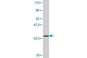 Western Blot detection against Immunogen (35. (ARHGEF7 antibody  (AA 102-190))