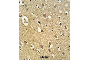 Immunohistochemistry (IHC) image for anti-Osteomodulin (OMD) antibody (ABIN3003236) (Osteomodulin antibody)