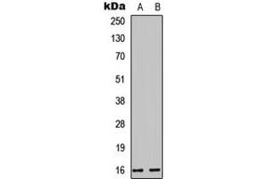 Western blot analysis of Cystatin E/M expression in HEK293T (A), PC12 (B) whole cell lysates. (CST6 antibody  (Center))