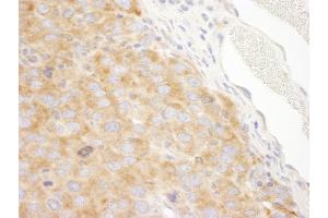 Immunohistochemistry (IHC) image for anti-DEAD (Asp-Glu-Ala-Asp) Box Polypeptide 3, X-Linked (DDX3X) (AA 1-50) antibody (ABIN7448520)