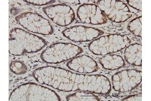 Image no. 1 for anti-Calcium and Integrin-Binding Protein 1 (CIB1) (AA 1-192) antibody (ABIN599142) (CIB1 antibody  (AA 1-192))