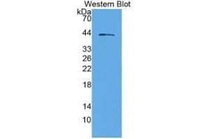 SDS-PAGE of Protein Standard from the Kit (Highly purified E. (IGFBPI CLIA Kit)