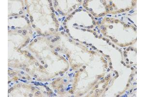 Immunohistochemistry (IHC) image for anti-Excision Repair Cross Complementing Polypeptide-1 (ERCC1) antibody (ABIN1876479)