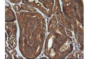 Image no. 1 for anti-Cyclin-Dependent Kinase Inhibitor 2B (p15, Inhibits CDK4) (CDKN2B) antibody (ABIN1497447) (CDKN2B antibody)