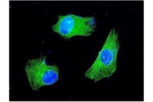 IF analysis of KChIP2 using anti-KChIP2 antibody (ABIN3043273). (KCNIP2 antibody  (N-Term))