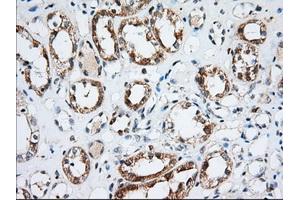 Immunohistochemical staining of paraffin-embedded Human Kidney tissue using anti-IGF2BP2 mouse monoclonal antibody. (IGF2BP2 antibody)