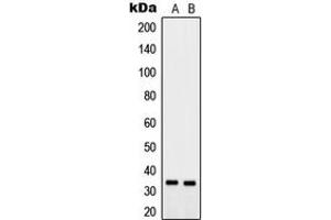 Western blot analysis of PTGR2 expression in MCF7 (A), PC12 (B) whole cell lysates.