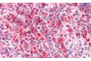 Detection of AZU in Human Spleen Tissue using Polyclonal Antibody to Azurocidin (AZU) (Azurocidin antibody  (AA 23-247))