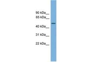 Image no. 1 for anti-Carboxypeptidase A6 (CPA6) (AA 359-408) antibody (ABIN6745550) (CPA6 antibody  (AA 359-408))