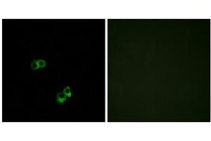 Immunofluorescence analysis of MCF-7 cells, using MC5R antibody.