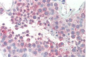 Immunohistochemistry (IHC) image for anti-Membrane-Associated Ring Finger (C3HC4) 10, E3 Ubiquitin Protein Ligase (MARCH10) (Internal Region) antibody (ABIN308396)