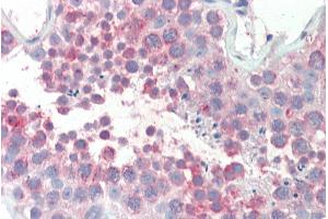 ABIN308396 (5µg/ml) staining of paraffin embedded Human Testis. (MARCH10 antibody  (Internal Region))