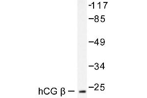 Image no. 1 for anti-Chorionic Gonadotropin (hCG) antibody (ABIN265452) (hCG antibody)