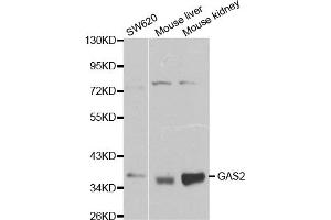 Western blot analysis of extracts of various cell lines, using GAS2 antibody (ABIN5970514) at 1/1000 dilution. (GAS2 antibody)