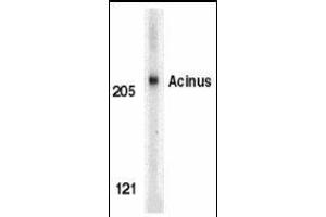 Western blot analysis of Acinus in K562 whole cell lysate with Acinus antibody (IN) at 1μg/ml. (ACIN1 antibody  (Cytoplasmic Domain))